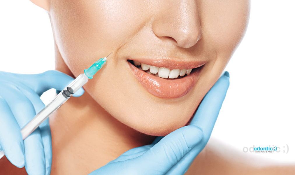 Hialuronidasa en estética debe ser aplicada por médicos